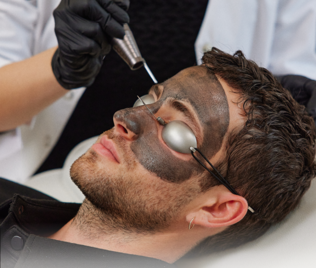 Homme traité au Carbon Peel