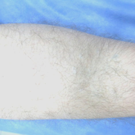 After image alt