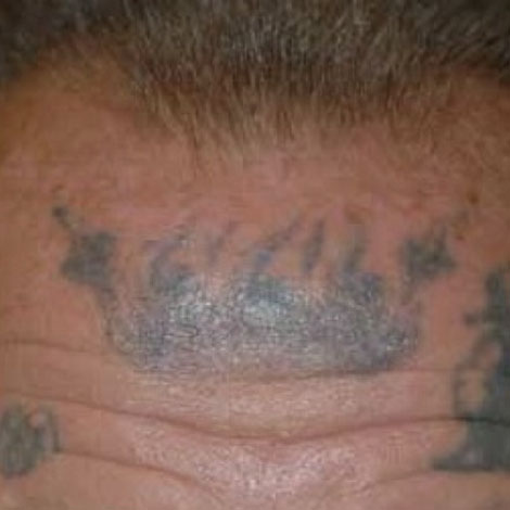 Before image alt