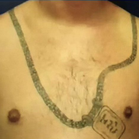 Before image alt