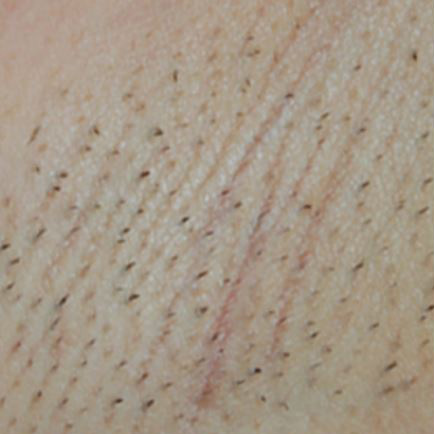 Before image alt
