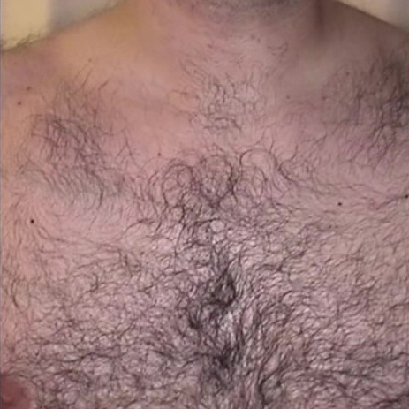 Before image alt