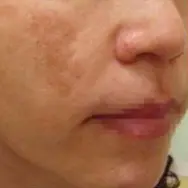 Before image alt