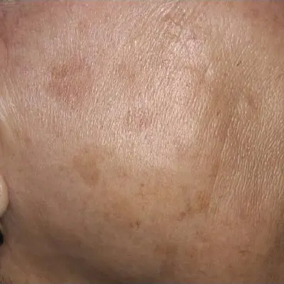 Before image alt