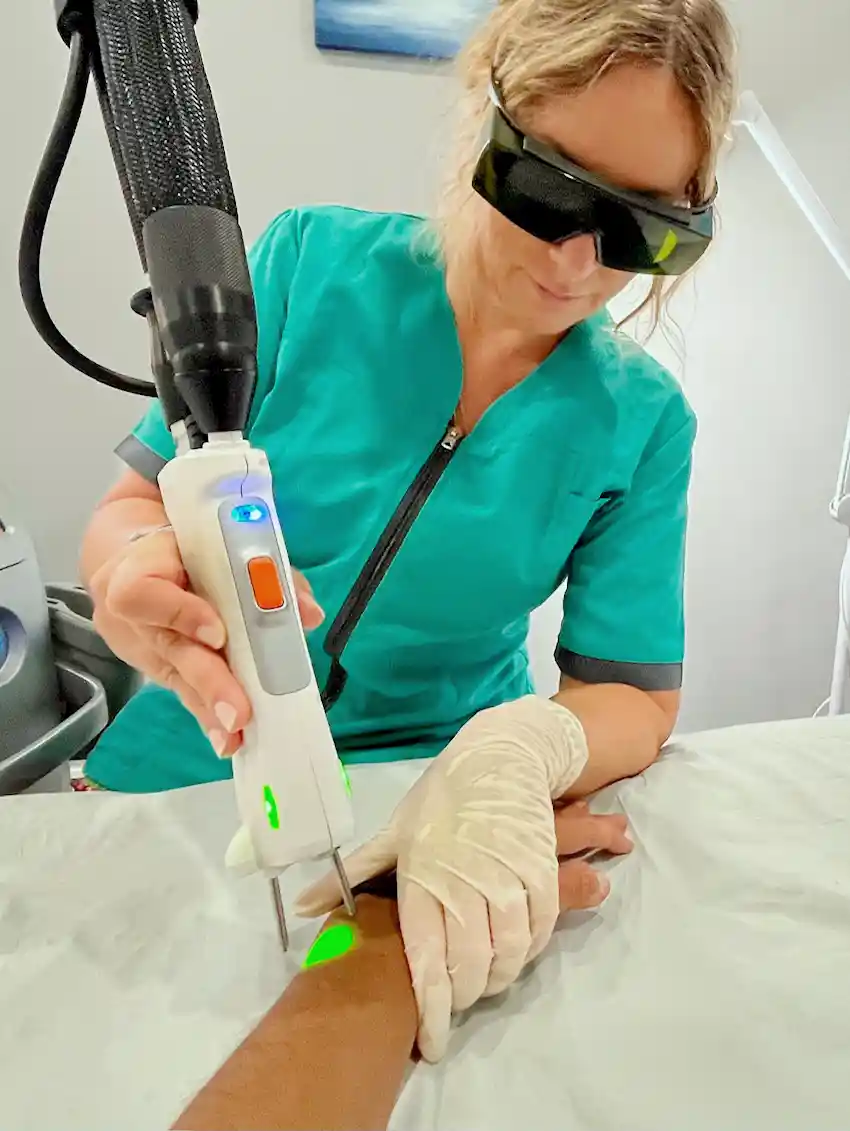 Sonia pratiquant une séance d'épilation laser