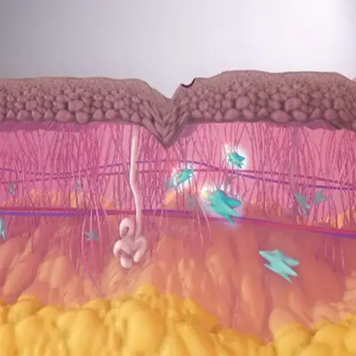 Schéma de l'arc plasma