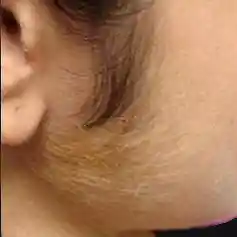 Before image alt