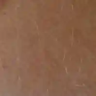Poils après un bleaching