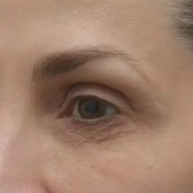 Before image alt