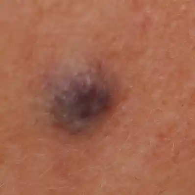 Before image alt