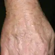 After image alt