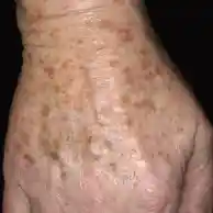Before image alt