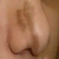 Before image alt