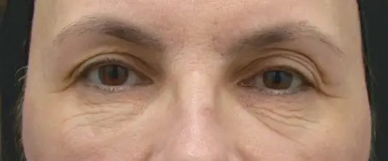 Before image alt